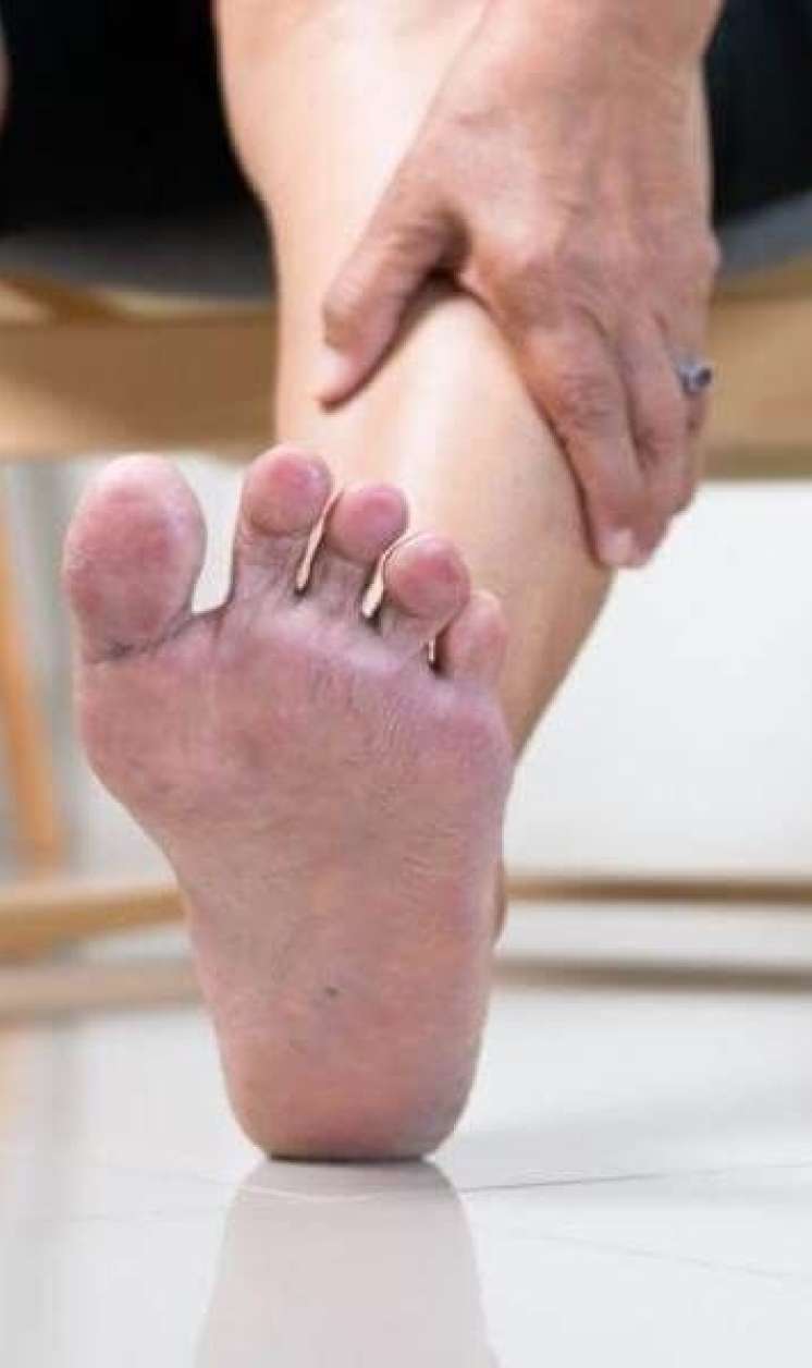 Diabetik ayaq sindromu: Amputasiyasız müalicə mümkündürmü? –  İnteqrativ tibb yanaşması-VİDEO