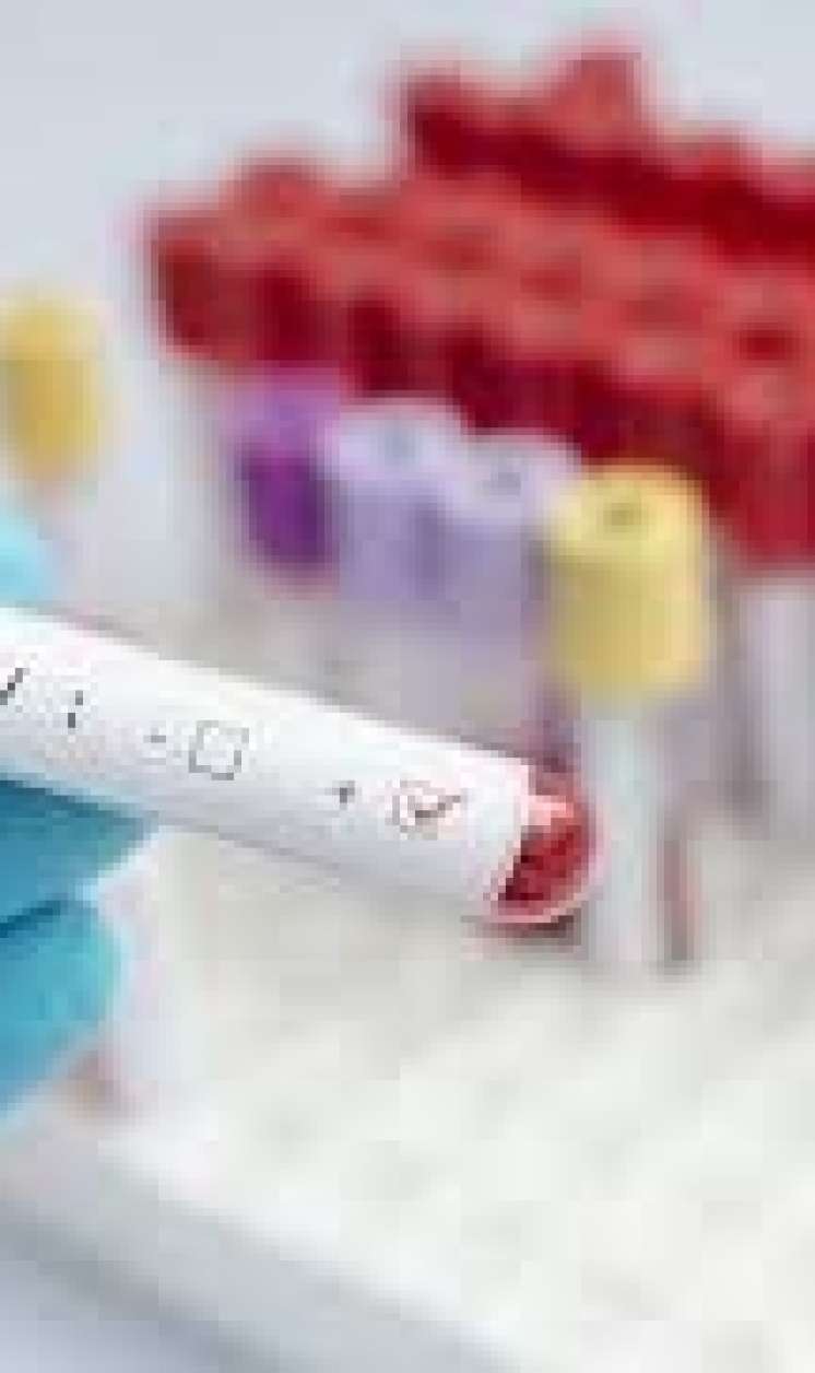 SPİD xəstəsi sağaldı  – Yeni metod