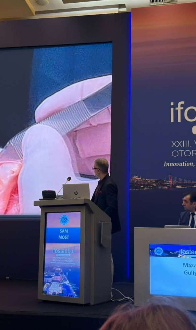 Azərbaycanlı LOR cərrahın innovativ metodikası    IFOS 2026 -da  təqdim edildi