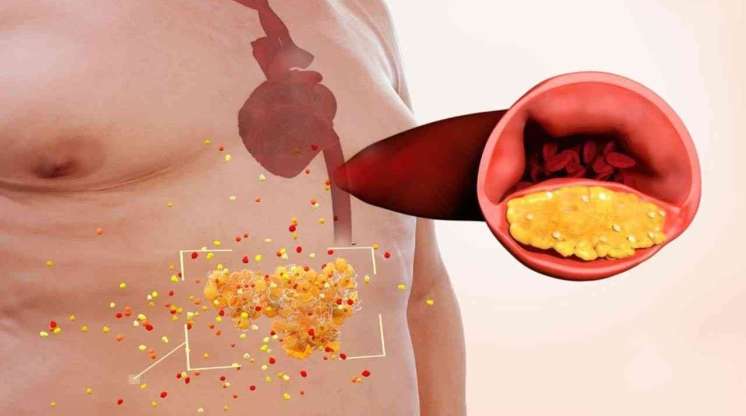  Kimlərdə daxili orqanlar piylənir?  – Diqqət