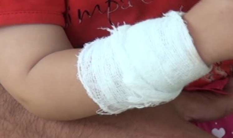 Sağlam uşağa "qolu sınıb" deyərək gips qoydular -  VİDEO