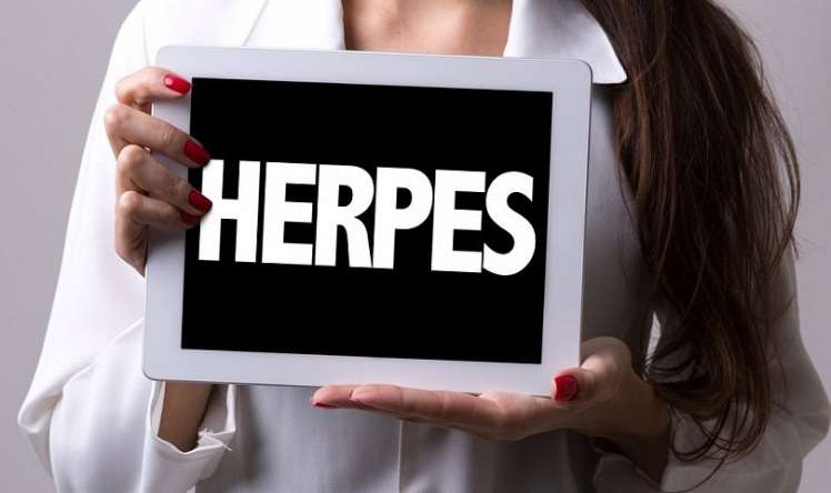 Öpüş, intim əlaqə və ağız suyu ilə yoluxan –  HERPES VİRUSU 