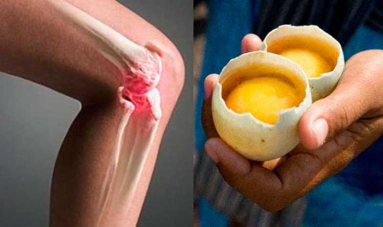 Diz ağrısına qarşı 2 yumurta –  Qədim dərman