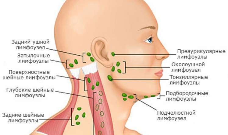 Limfa düyünləri niyə şişir –  Onkoloji xəstəliyin ilkin əlamətlərindən biri ola bilər