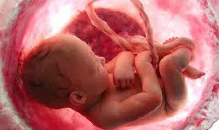 3 dəfə  düşük keçirmiş qadının uğurlu hamiləliyi -   Düşüklərin genetik səbəbi