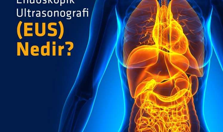 Endoskopik USM – adi aparatların görə bilmədiyi orqanları da görür və yerindəcə biopsi götürülür –  LİV Hospitalda