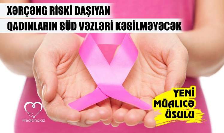 Xərçəng riski daşıyan qadınların süd vəzləri kəsilməyəcək –  Yeni müalicə üsulu