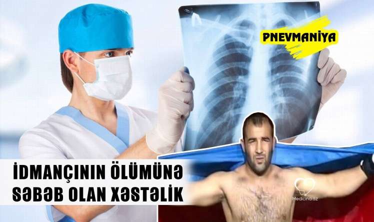 İdmançının ölümünə səbəb olan xəstəlik -  Pnevmaniya