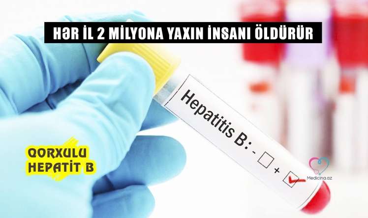 - Hər il 2 milyona yaxın insanı öldürür Qorxulu Hepatit B 