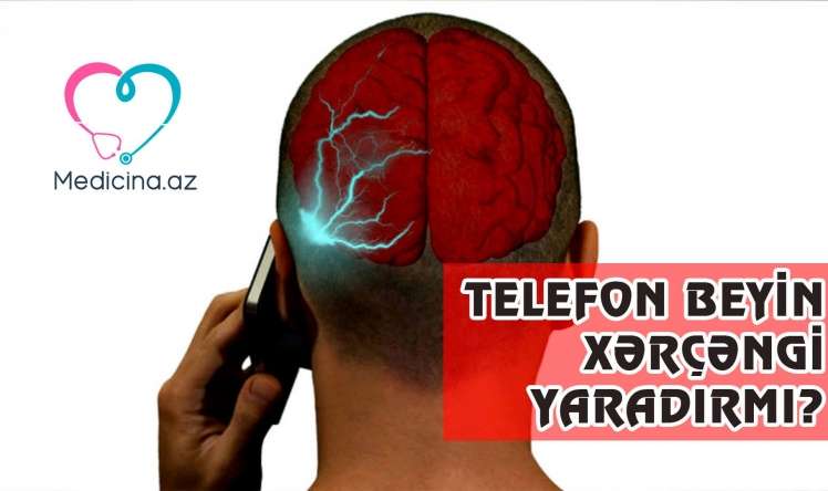 Mobil telefon xərçəngə səbəb olurmu? -  Alimdən açıqlama-VİDEO