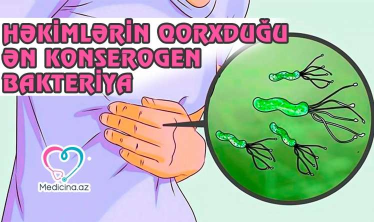 Mədə xərçənginin səbəbkarı bakteriya: Helicobacter Pylori -  VİDEO