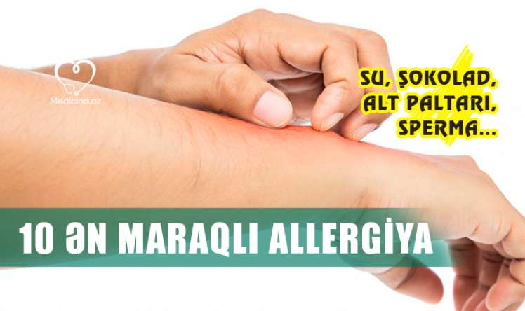 10 ən maraqlı allergiya –  Su, şokolad, alt paltarı, sperma...