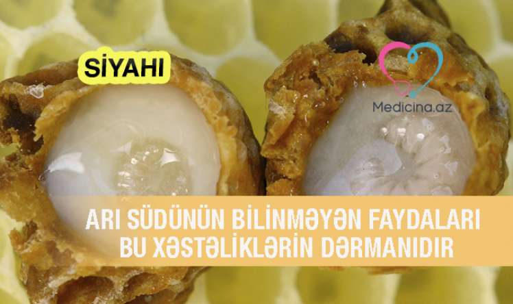 Arı südünün bilinməyən faydaları -  Bu xəstəliklərin dərmanıdır - SİYAHI