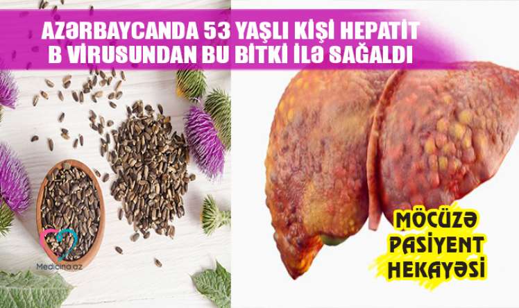 Azərbaycanda 53 yaşlı kişi Hepatit B virusundan bu bitki ilə sağaldı –  Möcüzə pasiyent hekayəsi