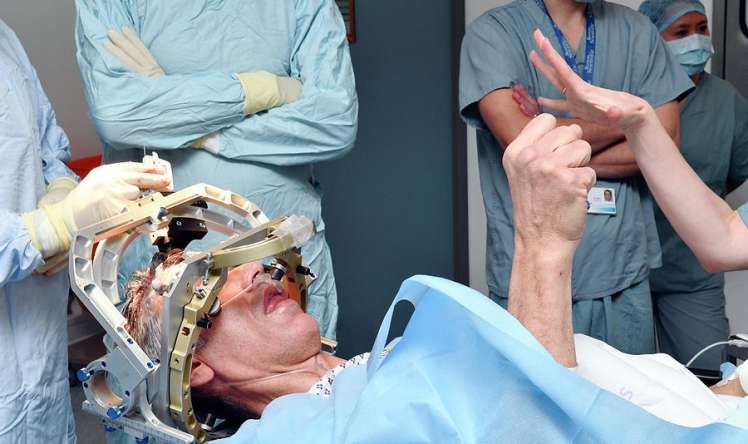 Parkinson, epilepsiya və psixiatrik xəstələrin müalicəsində yenilik  