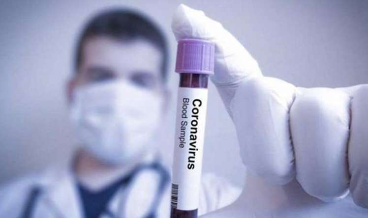 ÜST:   Koronavirus güclü epidemiya deyil