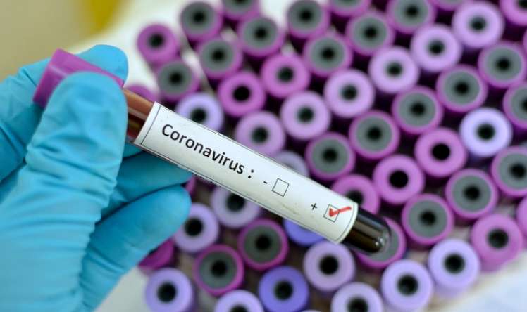 Bu ölkələrdə koronavirus qeydə alınıb -   SİYAHI