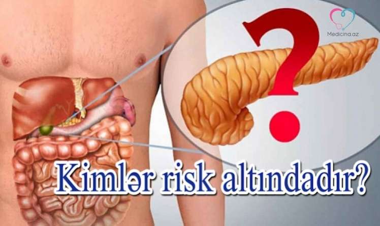 Mədəaltı vəzinin ən acımasız xəstəliyi PANKREATİT –   ƏLAMƏTLƏR - VİDEO 