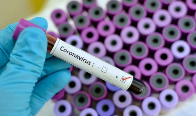 ÜST əməkdaşı İranda   koronavirusa yoluxdu