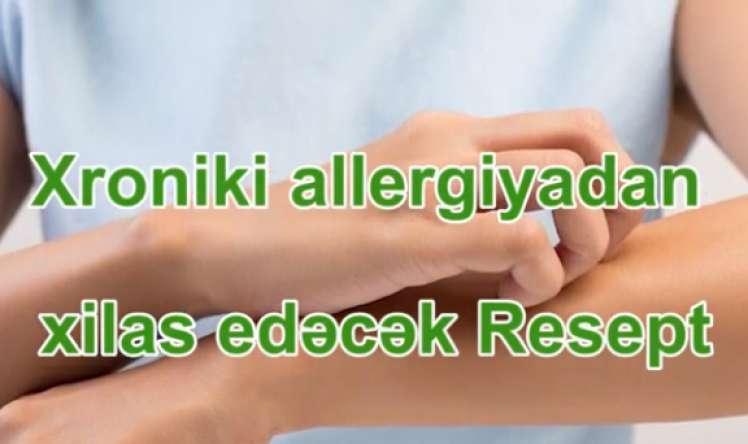 Xroniki allergiyadan xilas edəcək   RESEPT - VİDEO 