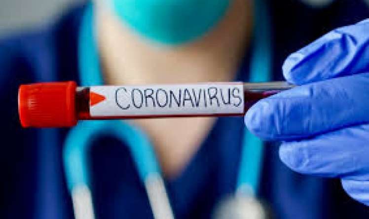ÜST koronavirusla bağlı   son rəqəmləri açıqladı