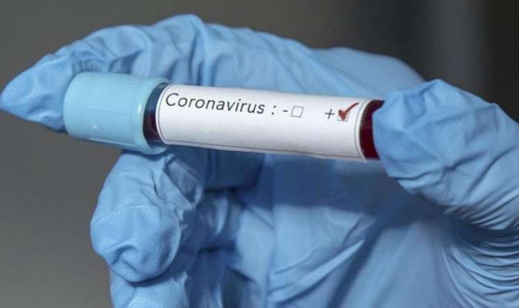 Fransada koronavirusa yoluxan azərbaycanlıların sayı artdı 