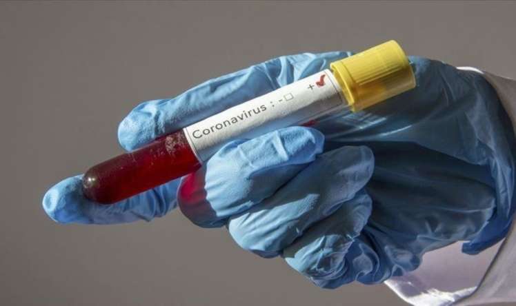 İran da koronavirusa qarşı dərman hazırladı 