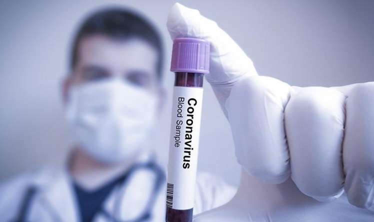  Ölkədə koronavirusun pik həddə çatma vaxtı hesablanır -  RƏSMİ 