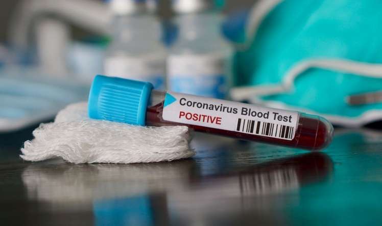 Gürcüstanda koronavirusa 134 nəfər yoluxub 