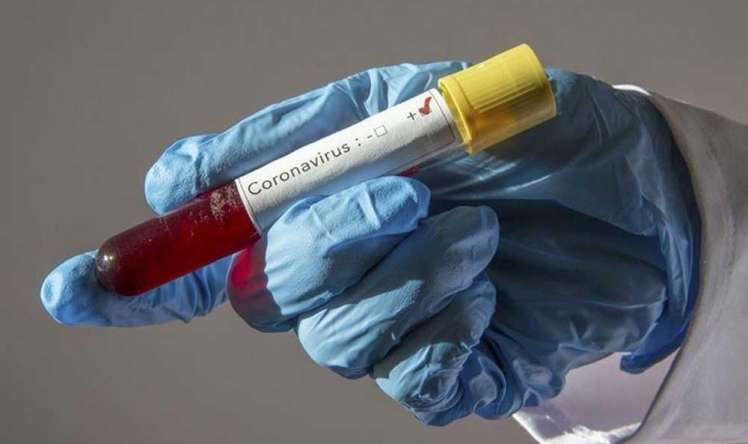 Türkiyədə 500-dən çox insan koronavirusdan öldü 