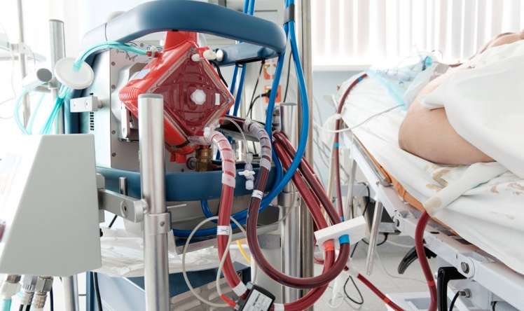 Ağır koronaviruslu xəstələrə tətbiq olunan ECMO nədir? - Həkimin yazısı