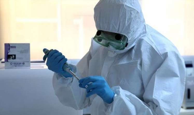 Azərbaycanda daha 76 nəfərdə koronavirus aşkarlandı   - 1 nəfər öldü