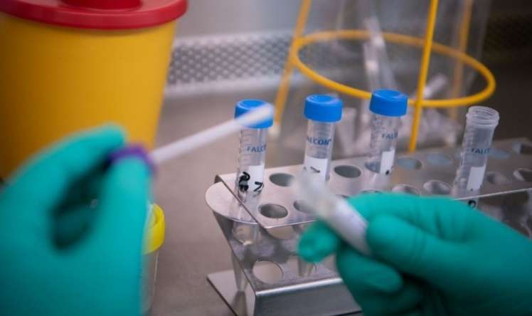Hindistan şirkətləri koronavirus üçün sürətli test istehsalına başlayacaq  