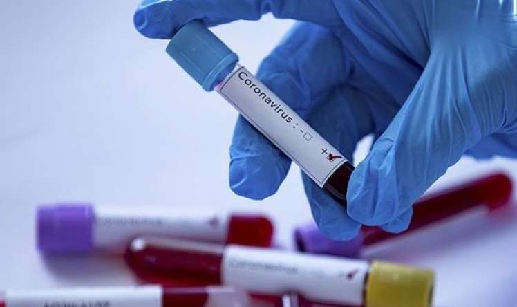 Azərbaycanda daha iki nəfər koronavirusdan öldü, 30 yeni yoluxma aşkarlandı  - RƏSMİ