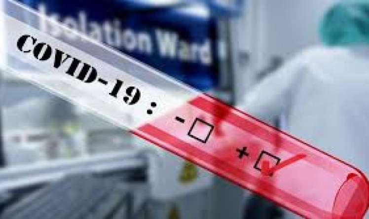 Koronavirus antitelini təyin edən analizlər aparılacaq   – Xəstəliyi gizli keçirənlər məlum olacaq