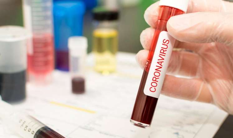 Koronavirusu zərərsizləşdirən anticisimlər aşkarlandı 