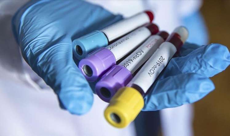 Azərbaycanda daha 67 nəfərdə koronavirus aşkarlandı   - 2 nəfər vəfat etdi