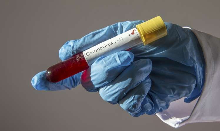 Azərbaycanda daha 97 nəfərdə koronavirus aşkarlandı 