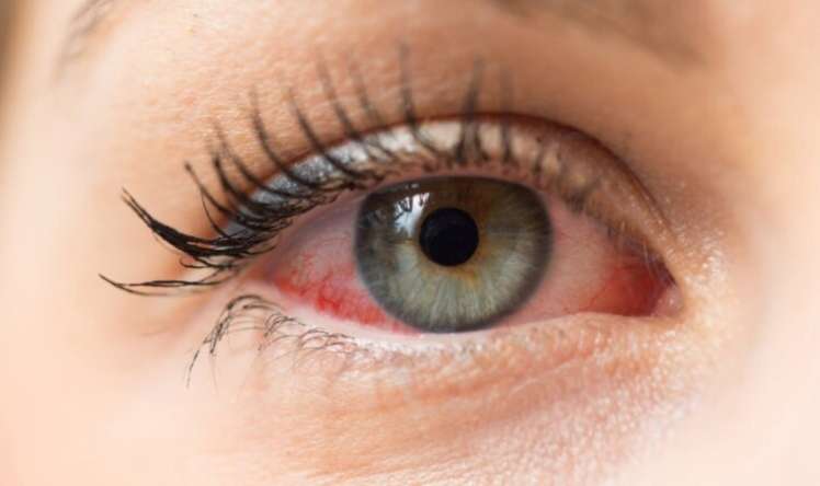 Koronavirus gözlərdən yoluxur, eynək taxın   -  ALİMLƏR