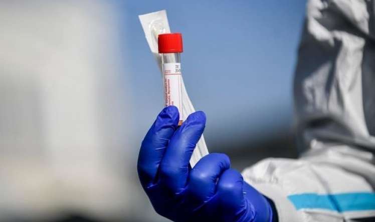 Koronavirus testləri hansı halda səhv göstərə bilər? 