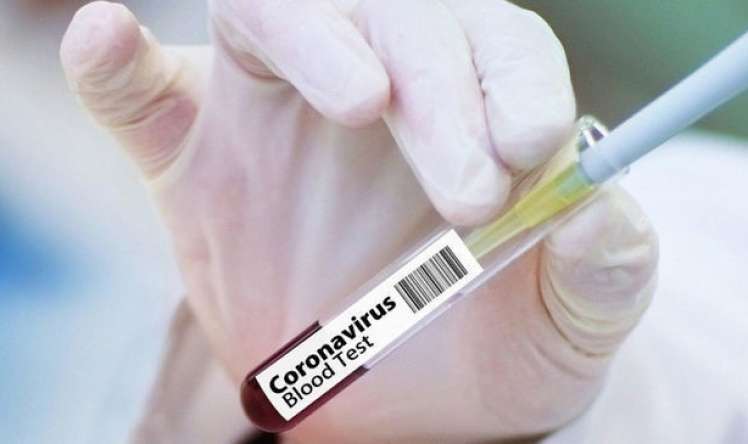 Bu ölkədə 357 nəfərə səhvən koronavirus diaqnozu qoyuldu 