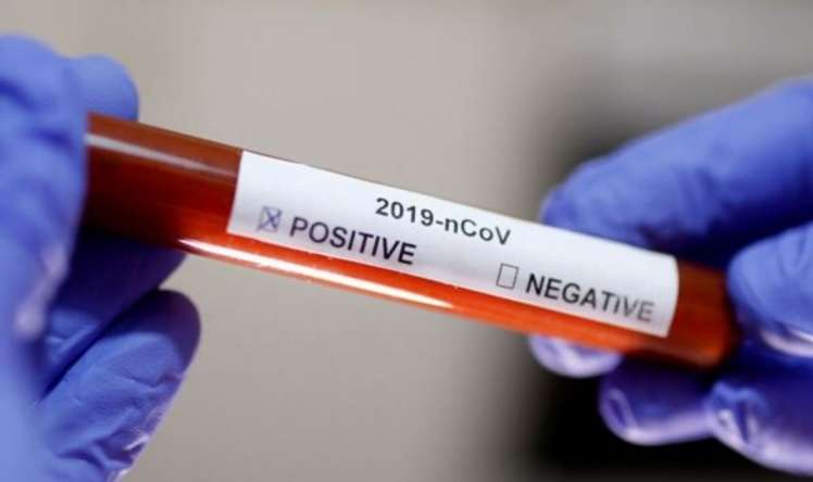 Dünyada 350 mindən çox insan koronavirusdan öldü 