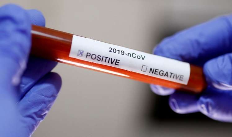 Daha 314 nəfərdə koronavirus aşkarlandı -  4 nəfər öldü