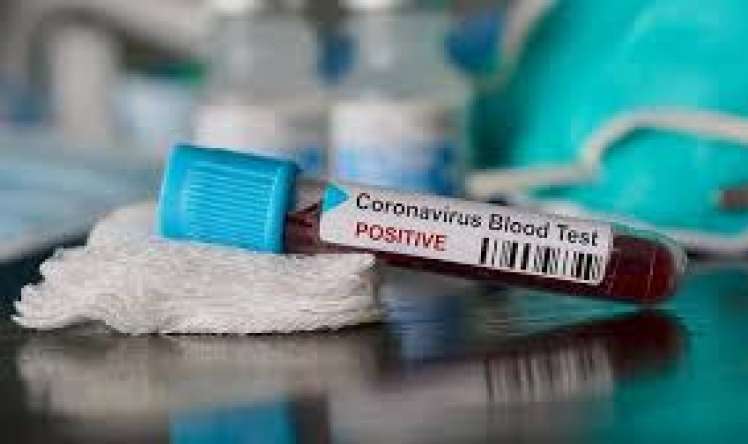 Azərbaycanda daha 478 nəfərdə koronavirus aşkarlandı  - 7 nəfər öldü