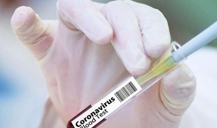 Azərbaycanda koronavirus olan daha bir müğənni öldü  