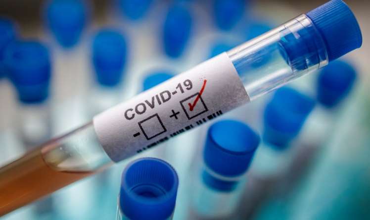 Koronavirusun Parkinson xəstəliyi ilə bağlılığı aşkarlandı 