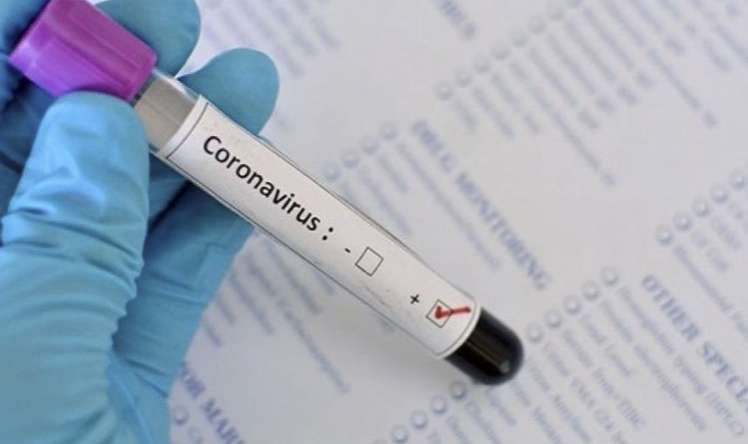 İranda indiyədək 10 min şagird koronavirusa yoluxub 