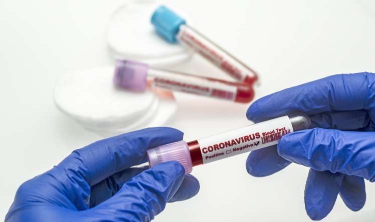 Ermənistanda daha 543 nəfərdə koronavirus aşkarlandı 