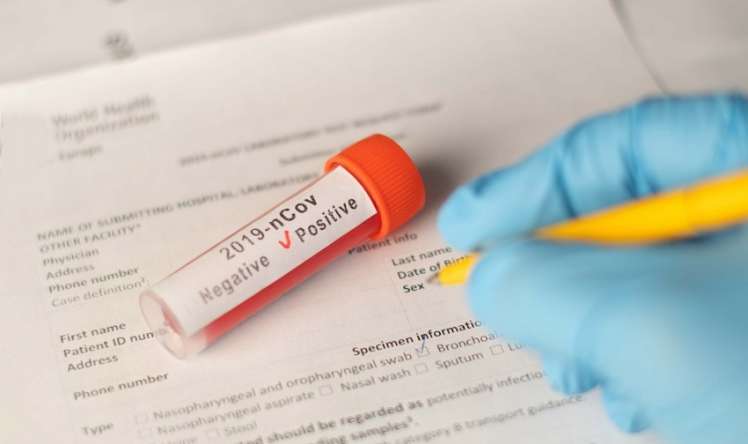 Özəl klinikalarda koronavirus testlərinin qiymətləri endirilə bilər?  AÇIQLAMA