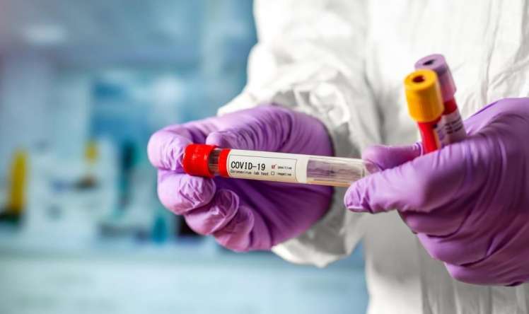 Ukraynada yeni ekspres koronavirus testləri istifadəyə veriləcək 